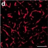Detection of Human PLGF by Block/Neutralize