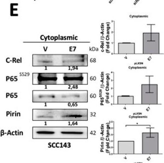 Detection of c-Rel by Western Blot