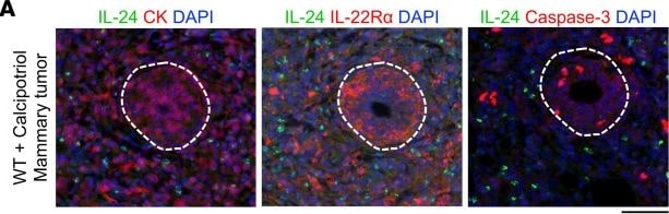 Detection of IL-24 by Immunohistochemistry