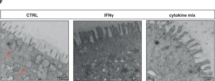 Detection of IFN-gamma by Immunohistochemistry