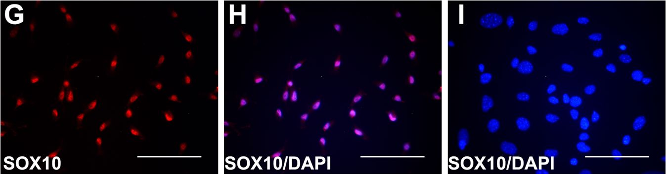 Detection of Mouse SOX10 by Immunocytochemistry/Immunofluorescence