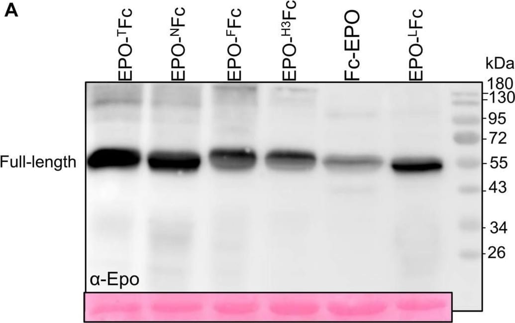 Detection of Erythropoietin/EPO by Western Blot