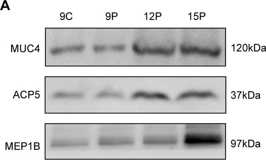 Detection of Meprin  beta  Subunit/MEP1B by Western Blot