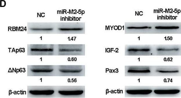 Detection of IGF-II/IGF2 by Western Blot