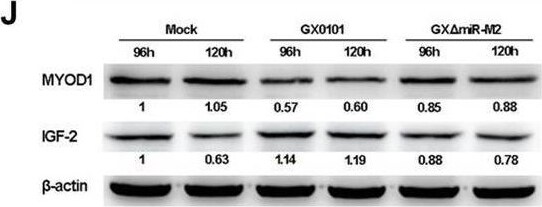 Detection of IGF-II/IGF2 by Western Blot