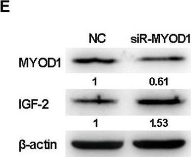 Detection of IGF-II/IGF2 by Western Blot