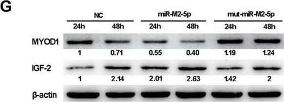 Detection of IGF-II/IGF2 by Western Blot