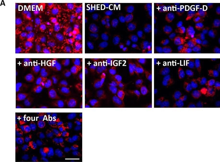 Detection of IGF-II/IGF2 by Immunocytochemistry/ Immunofluorescence