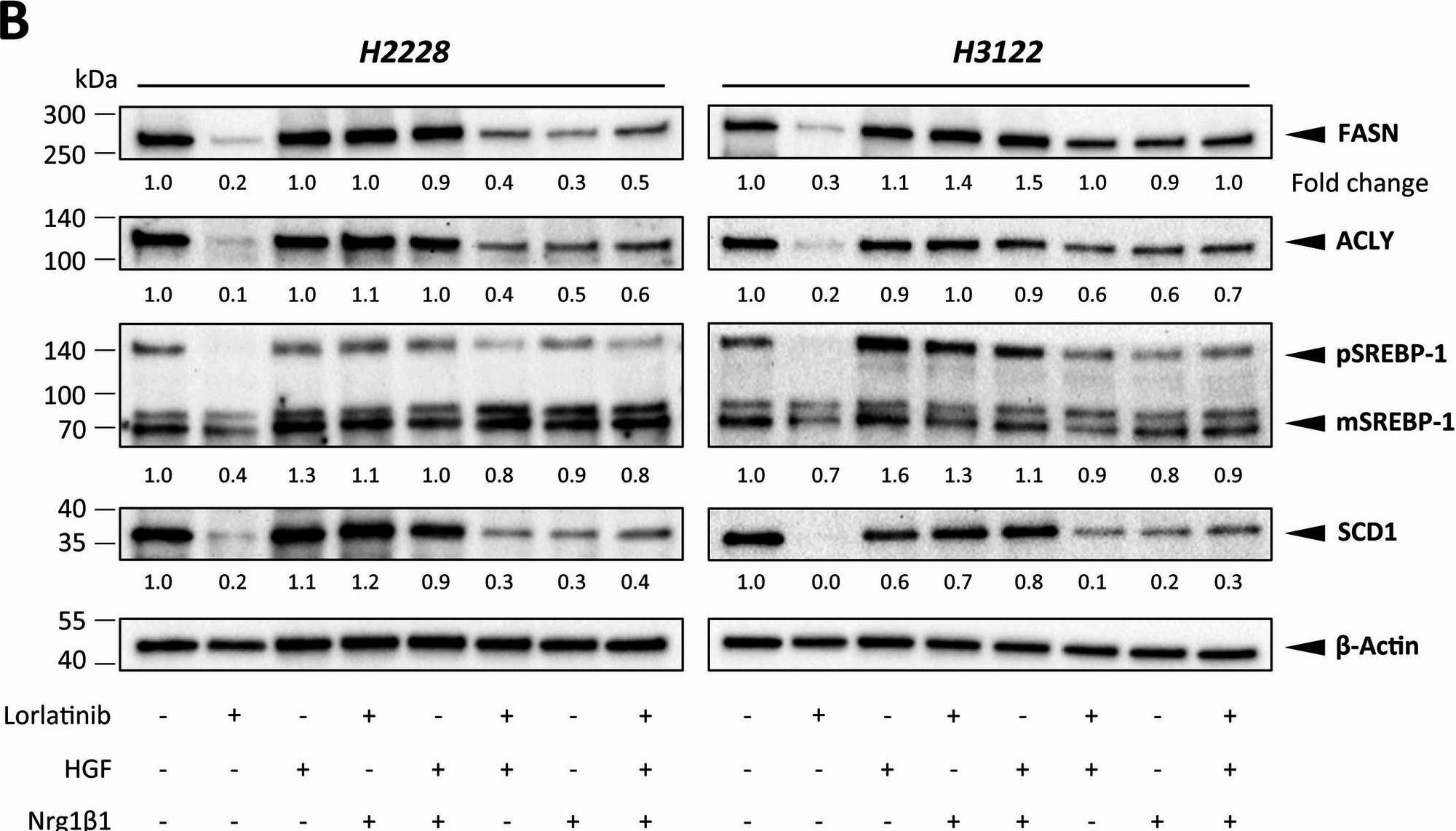 Detection of HGF by Western Blot