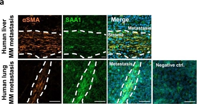 Detection of Serum Amyloid A1 by Immunohistochemistry