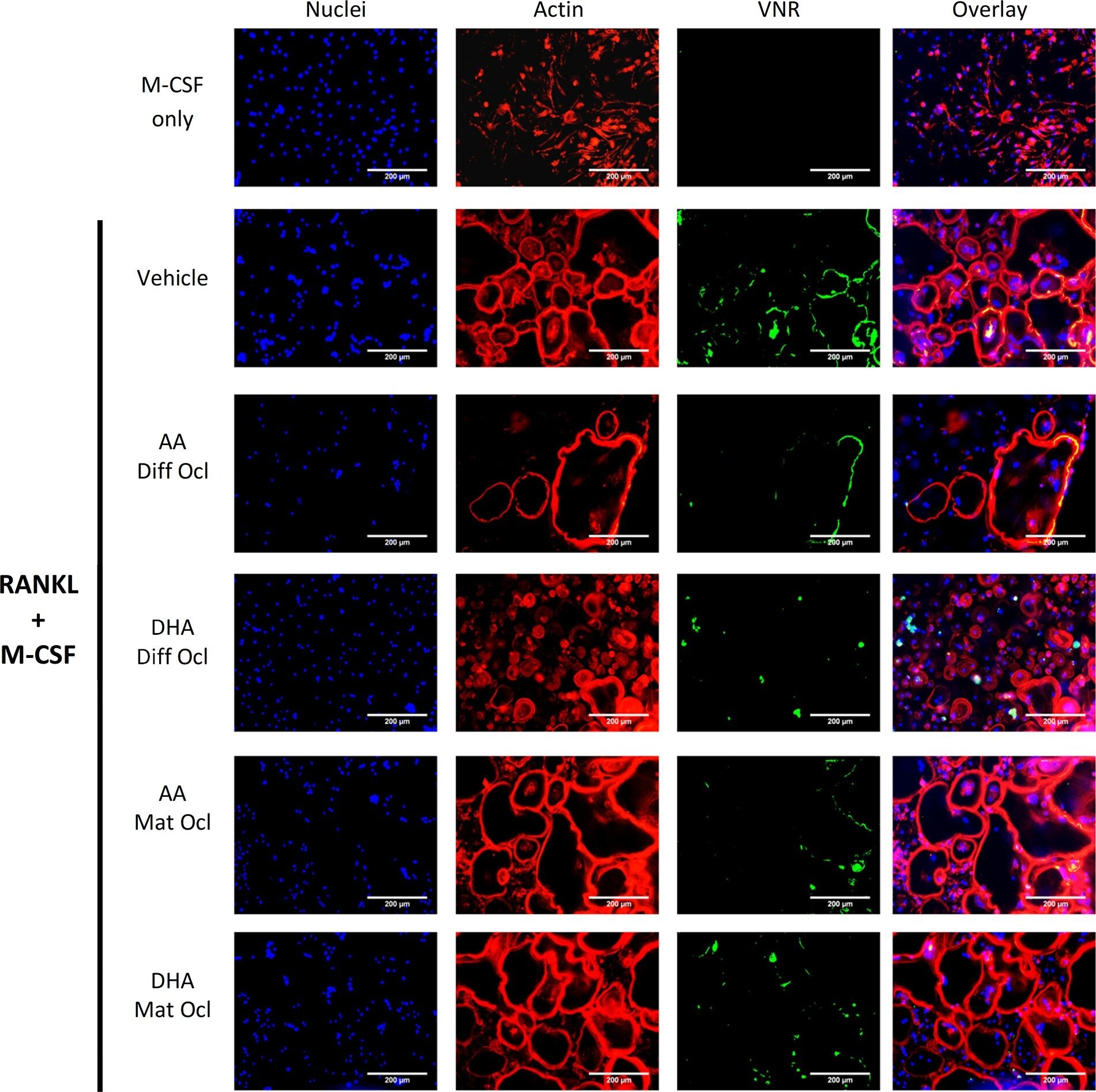 Detection of Integrin alpha V beta 3 by Immunocytochemistry/ Immunofluorescence