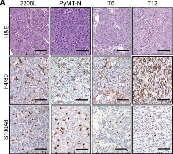 Detection of S100A8 by Immunohistochemistry
