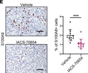 Detection of S100A8 by Immunohistochemistry