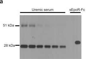 Detection of Human Erythropoietin R by Western Blot