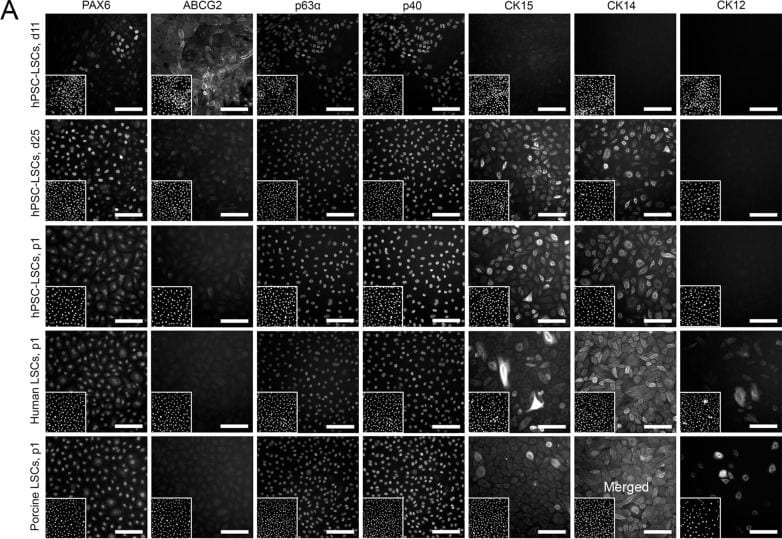 Detection of Cytokeratin 14 by Immunocytochemistry/ Immunofluorescence