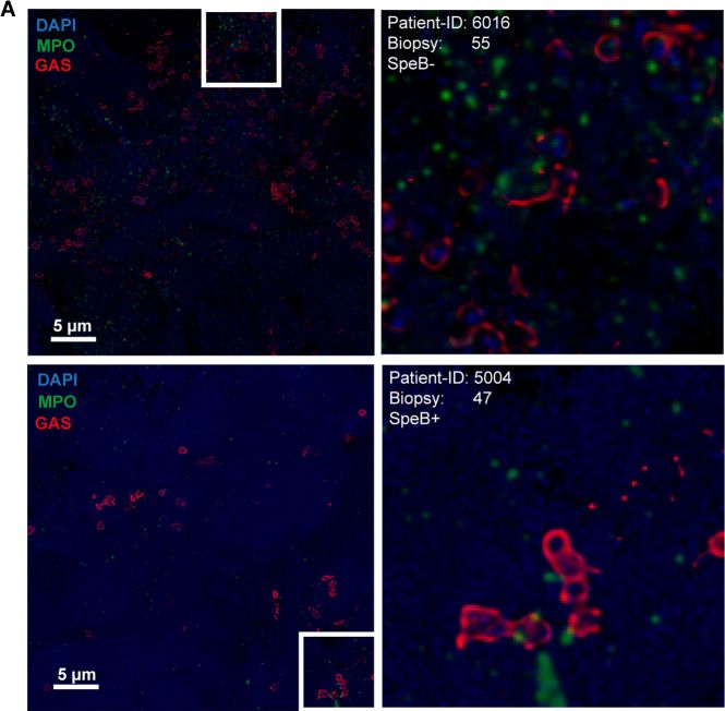Detection of Myeloperoxidase by Immunohistochemistry