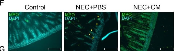Detection of Myeloperoxidase by Immunohistochemistry