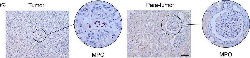 Detection of Myeloperoxidase by Immunohistochemistry