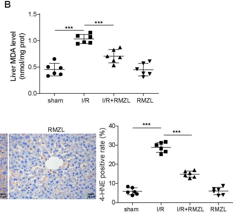 Detection of Mouse 4-Hydroxynonenal by Immunohistochemistry