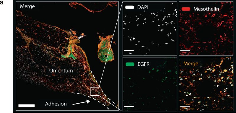 Detection of Mesothelin by Immunohistochemistry