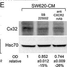 Detection of CXCR2/IL-8RB by Western Blot