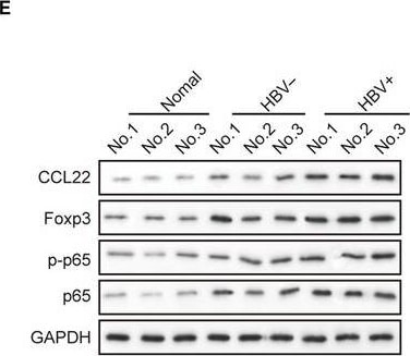 Detection of Human CCL22/MDC by Western Blot