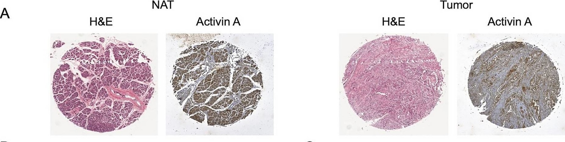 Detection of Activin A  beta A subunit by Immunohistochemistry