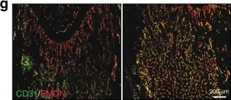 Detection of CD31/PECAM-1 by Immunohistochemistry