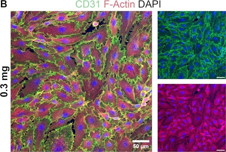 Detection of CD31/PECAM-1 by Immunohistochemistry