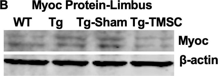 Detection of Mouse Myocilin by Western Blot