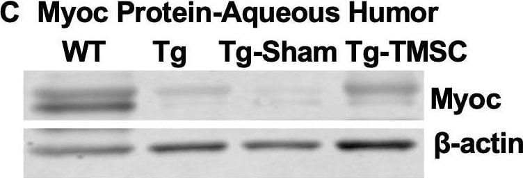 Detection of Mouse Myocilin by Western Blot