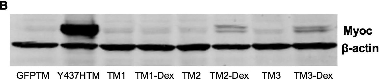 Detection of Mouse Myocilin by Western Blot