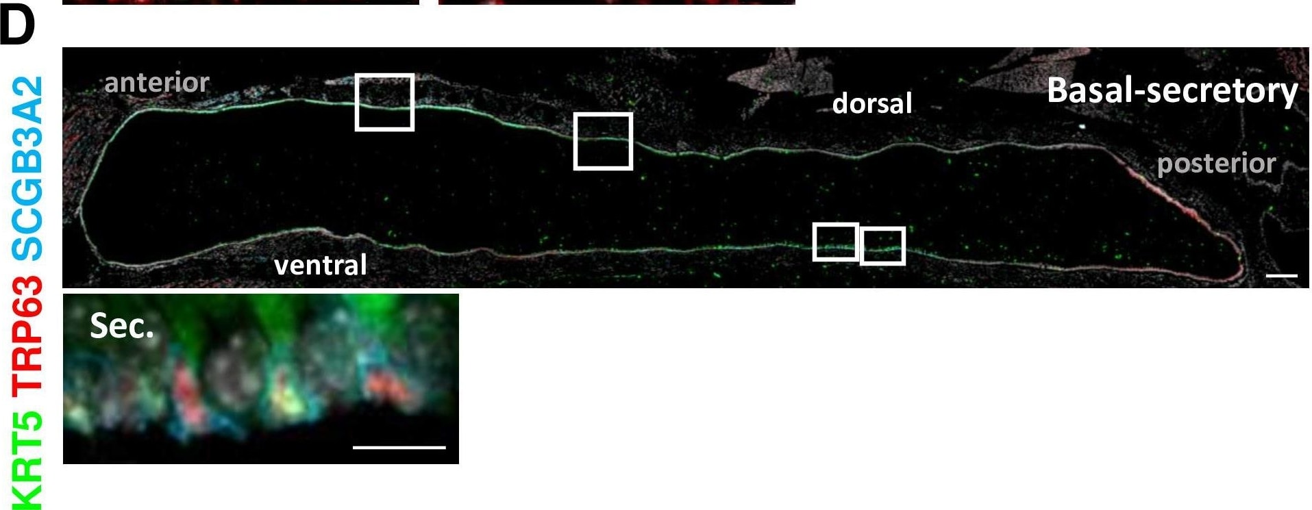 Detection of Mouse UGRP1/SCGB3A2 by Immunohistochemistry