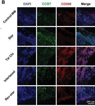 Detection of CCR7 by Immunocytochemistry/ Immunofluorescence