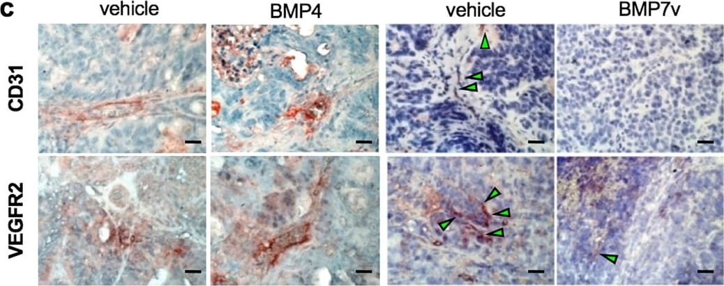 Detection of Human BMP-7 by Immunohistochemistry