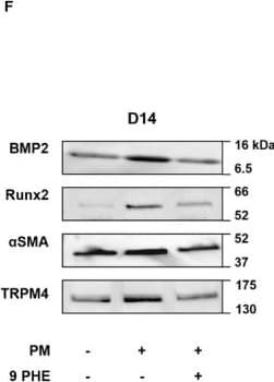 Detection of BMP-2 by Western Blot