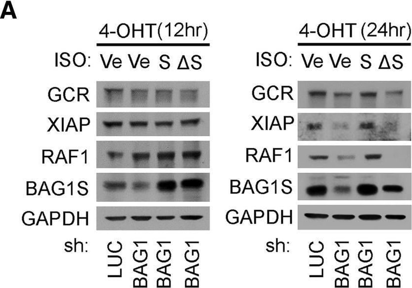 Detection of RIPK1/RIP1 by Western Blot