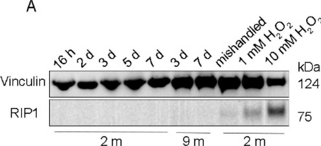 Detection of RIPK1/RIP1 by Western Blot