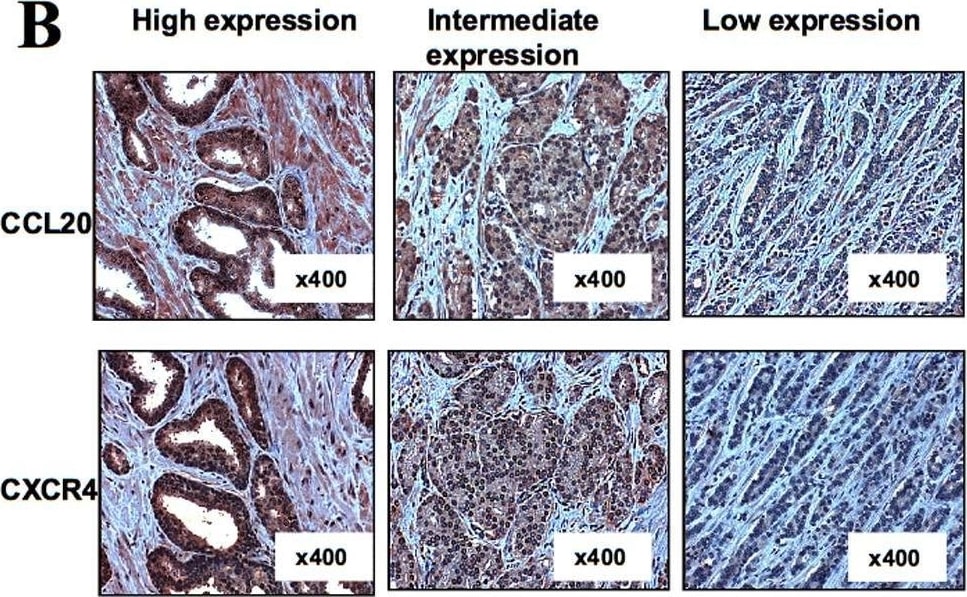 Detection of CCL20/MIP-3 alpha by Immunohistochemistry
