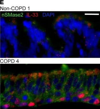 Detection of IL-33 by Immunohistochemistry