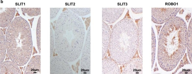 Detection of Slit3 by Immunohistochemistry