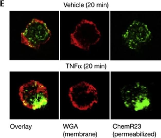 Detection of ChemR23/CMKLR1 by Immunocytochemistry/ Immunofluorescence