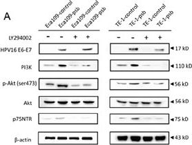 Detection of NGFR/TNFRSF16 by Western Blot