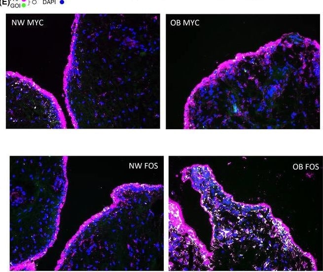 Detection of Human c-Myc by Immunohistochemistry