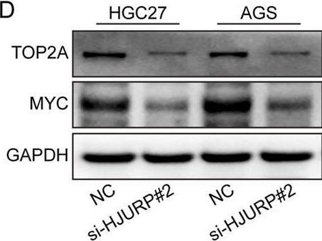 Detection of cpurpszdwsf34dihzghe.jpg by Western Blot