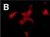 Detection of Human CD4 by Immunohistochemistry