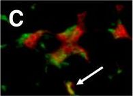 Detection of Human CD4 by Immunohistochemistry