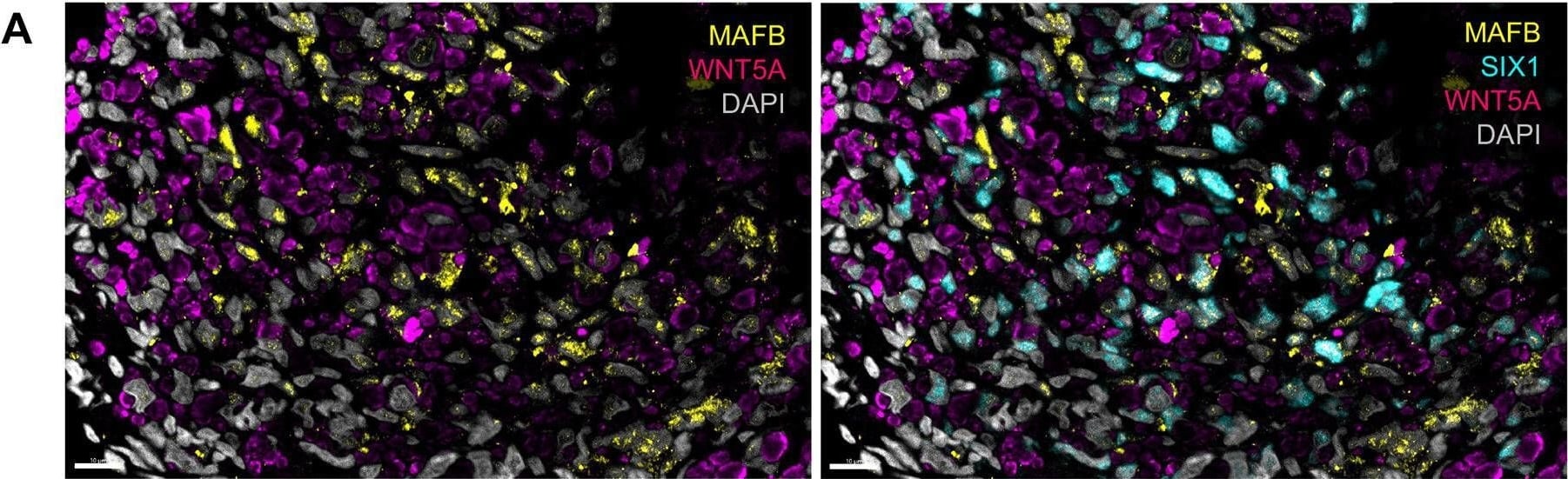 Detection of MafB by Immunohistochemistry