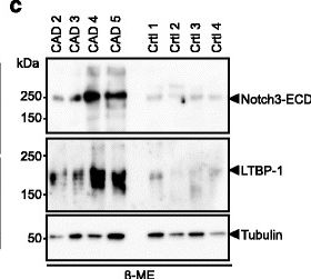 Detection of Latent TGF¿ beta  bp1 by Western Blot