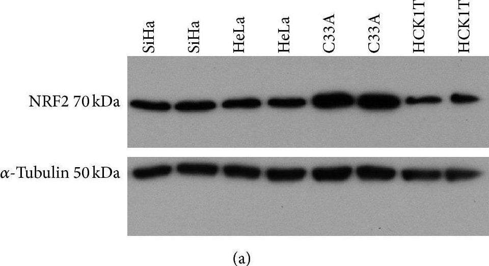 Detection of Human Nrf2 by Western Blot